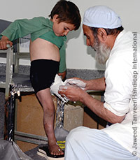 Sayed bekommt eine Prothese